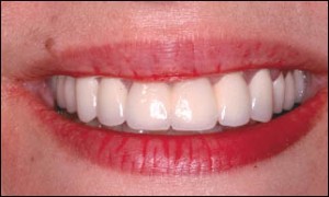 Smile Creation